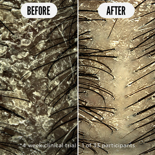 Care Taker Kopfhaut-Tonikum - 75ml